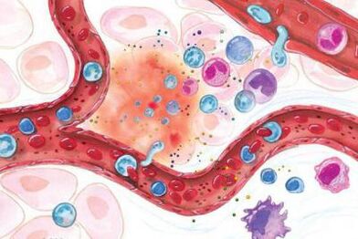 Effetto della Boswellia sulle zone infiammate del corpo